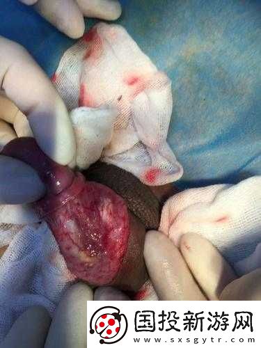 小弟里面有白色的東西怎么清理：實(shí)用方法分享