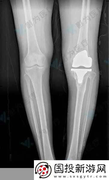 骨科新線路解析：為患者提供更便捷服務