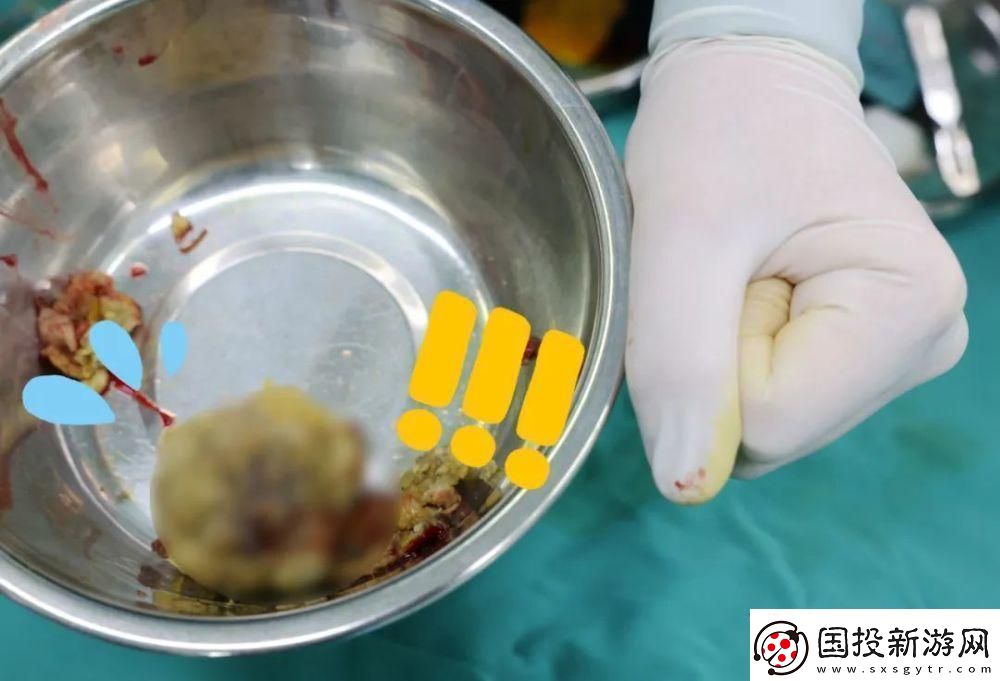 “腸”界翹楚-拳頭“新星”：游戲界的另類傳奇