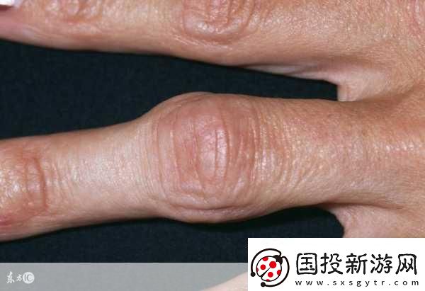 寶寶怎么才三根手指就痛1.寶寶為何三根手指就感到疼痛