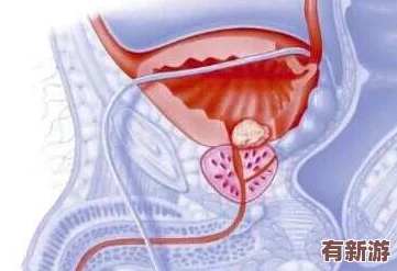 手腳綁起來拿刷子刷尿道孔的行為背后隱藏著怎樣的心理與動(dòng)機(jī)